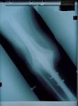 Orthodynamics Mayday Nail